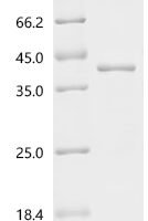 Arabidopsis thaliana Target of rapamycin complex subunit LST8-1 (LST8-1) Recombinant Protein - BioCrest Sci