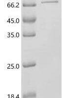 Human Dihydropyrimidinase-related protein 5 (DPYSL5) Recombinant Protein, C-10His - BioCrest Sci