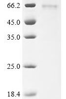 Mouse C-type lectin domain family 18 member A (Clec18a) Recombinant Protein, C-His - BioCrest Sci