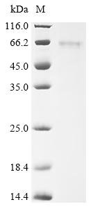 Mouse C-type lectin domain family 18 member A (Clec18a) Recombinant Protein, C-His, Mus musculus (Mouse), Baculovirus, C-terminal 6xHis-tagged, 61.4 kDa, purity >≥ 85% as determined by SDS-PAGE.