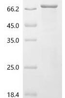 Zobellia galactanivorans Iota-carrageenase (cgiA) Recombinant Protein - BioCrest Sci