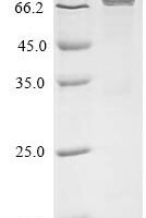 Human Eosinophil peroxidase (EPX) Recombinant Protein, N-His - BioCrest Sci