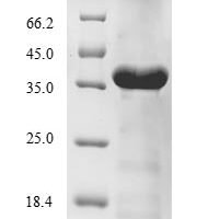 Desulfotalea psychrophila DNA ligase (ligA), partial Recombinant Protein - BioCrest Sci