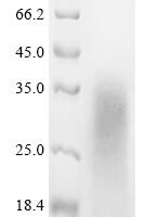 Mouse Myelin basic protein (Mbp) Recombinant Protein - BioCrest Sci