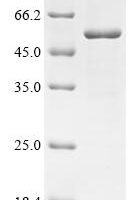 Human Transmembrane protease serine 4 (TMPRSS4), partial Recombinant Protein, N-10His/C-Myc - BioCrest Sci