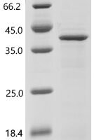 Human A disintegrin and metalloproteinase with thrombospondin motifs 14 (ADAMTS14), partial Recombinant Protein - BioCrest Sci