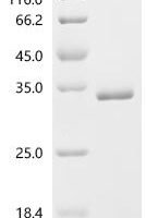 Human FAD-linked sulfhydryl oxidase ALR (GFER) Recombinant Protein - BioCrest Sci