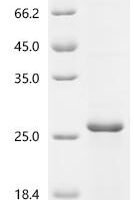 Escherichia coli Type 1 fimbrin D-mannose specific adhesin (fimH), partial Recombinant Protein - BioCrest Sci