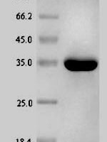 Escherichia coli Phosphoheptose isomerase (gmhA) Recombinant Protein - BioCrest Sci
