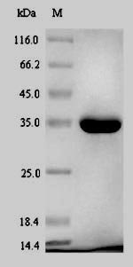 Escherichia coli Phosphoheptose isomerase (gmhA) Recombinant Protein, Escherichia coli (strain K12), E.coli, N-terminal 6xHis-SUMO-tagged, 36.8 kDa, purity >≥ 90% as determined by SDS-PAGE.
