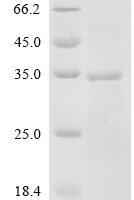 Human herpesvirus 1 Triplex capsid protein 2 (TRX2) Recombinant Protein, C-His - BioCrest Sci