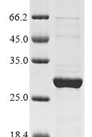 Canine distemper virus Protein C (P/V/C) Recombinant Protein - BioCrest Sci