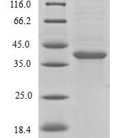 Human BH3-like motif-containing cell death inducer (BLID) Recombinant Protein - BioCrest Sci