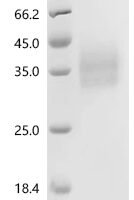 Human Leukocyte surface antigen CD47 (CD47), partial, Biotinylated Recombinant Protein, C-10His-Avi - BioCrest Sci