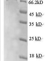Human Rab GDP dissociation inhibitor beta (GDI2), partial Recombinant Protein - BioCrest Sci