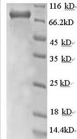 Human Rab GDP dissociation inhibitor beta (GDI2), partial Recombinant Protein, Homo sapiens (Human), E.coli, N-terminal GST-tagged, 77.2 kDa, purity >≥ 90% as determined by SDS-PAGE.
