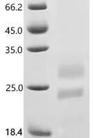 Human Interleukin-15 (IL15) Recombinant Protein, C-10His - BioCrest Sci