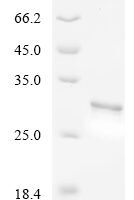 Human Cytochrome c oxidase subunit FA4 (COXFA4), partial Recombinant Protein, N-GST - BioCrest Sci