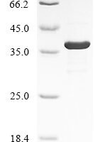 Human Intelectin-1 (ITLN1) Recombinant Protein - BioCrest Sci