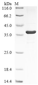 Human Intelectin-1 (ITLN1) Recombinant Protein, Homo sapiens (Human), E.coli, N-terminal 10xHis-tagged and C-terminal Myc-tagged, 38.6 kDa, purity >≥ 85% as determined by SDS-PAGE.