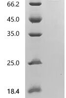 Human Dipeptidyl peptidase 4 (DPP4), partial Recombinant Protein, C-10His - BioCrest Sci