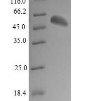 Human Valacyclovir hydrolase (BPHL) Recombinant Protein, N-His-SUMO - BioCrest Sci