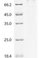 Human Serine/threonine-protein kinase B-raf (BRAF) Recombinant Protein - BioCrest Sci