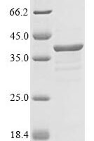 Human Myelin protein P0 (MPZ), partial Recombinant Protein, N-GST - BioCrest Sci