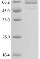 Saccharomyces cerevisiae ATP synthase subunit alpha, mitochondrial (ATP1) Recombinant Protein - BioCrest Sci