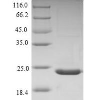 Chicken Collagen alpha-1 (XII) chain (COL12A1), partial Recombinant Protein, N-His, aa 139–311, Yeast - BioCrest Sci