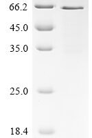 Human Cellular tumor antigen p53 (TP53) (Y220C) Recombinant Protein, N-His - BioCrest Sci