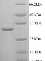 Rat Kininogen-1 (Kng1), partial Recombinant Protein - BioCrest Sci
