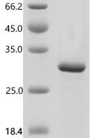 Human DNA dC->dU-editing enzyme APOBEC-3C (APOBEC3C) Recombinant Protein - BioCrest Sci