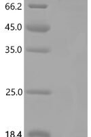 Human ATP-dependent 6-phosphofructokinase, platelet type (PFKP) Recombinant Protein - BioCrest Sci
