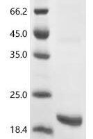Human Sphingosine 1-phosphate receptor 5 (S1PR5), partial Recombinant Protein - BioCrest Sci