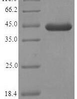 Mouse EF-hand domain-containing protein D2 (Efhd2) Recombinant Protein - BioCrest Sci