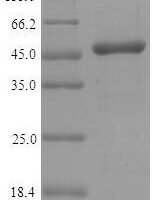 Mouse Interferon regulatory factor 3 (Irf3) Recombinant Protein, N-10His/C-Myc, aa 1–419, Yeast - BioCrest Sci