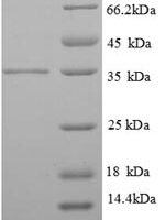 Human Tropomyosin beta chain (TPM2), partial Recombinant Protein - BioCrest Sci