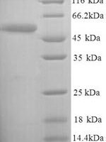 Salmonella heidelberg D-serine dehydratase (dsdA) Recombinant Protein - BioCrest Sci