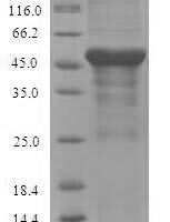 Mouse Serine--pyruvate aminotransferase, mitochondrial (Agxt) Recombinant Protein, N-His-SUMO - BioCrest Sci