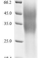 Human Tumor necrosis factor receptor superfamily member 10D (TNFRSF10D), partial Recombinant Protein, C-His - BioCrest Sci