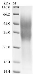 Human Tumor necrosis factor receptor superfamily member 10D (TNFRSF10D), partial Recombinant Protein, C-His, Homo sapiens (Human), Yeast, C-terminal 6xHis-tagged, 18.3 kDa, purity >≥ 90% as determined by SDS-PAGE.