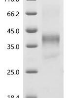 Human Tumor necrosis factor receptor superfamily member 1A (TNFRSF1A), partial Recombinant Protein, C-Twin-Strep-Avi - BioCrest Sci