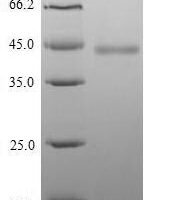 Mouse Hyaluronan and proteoglycan link protein 1 (Hapln1) Recombinant Protein, N-His-Myc - BioCrest Sci