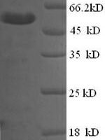 Human Membrane-associated phosphatidylinositol transfer protein 1 (PITPNM1), partial Recombinant Protein - BioCrest Sci