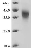 Epstein-Barr virus Glycoprotein 42 (BZLF2), partial Recombinant Protein, C-His, aa 34–223, Mammalian cell - BioCrest Sci