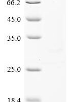 Human Bone morphogenetic protein 3B (GDF10) Recombinant Protein - BioCrest Sci
