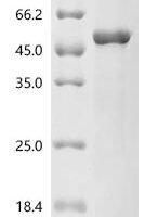 Human Caspase-10 (CASP10), partial Recombinant Protein - BioCrest Sci