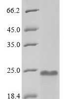 Human Prothymosin alpha (PTMA) Recombinant Protein, N-10His - BioCrest Sci