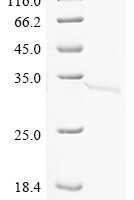 Salmonella dublin Virulence protein VsdF (vsdF) Recombinant Protein - BioCrest Sci